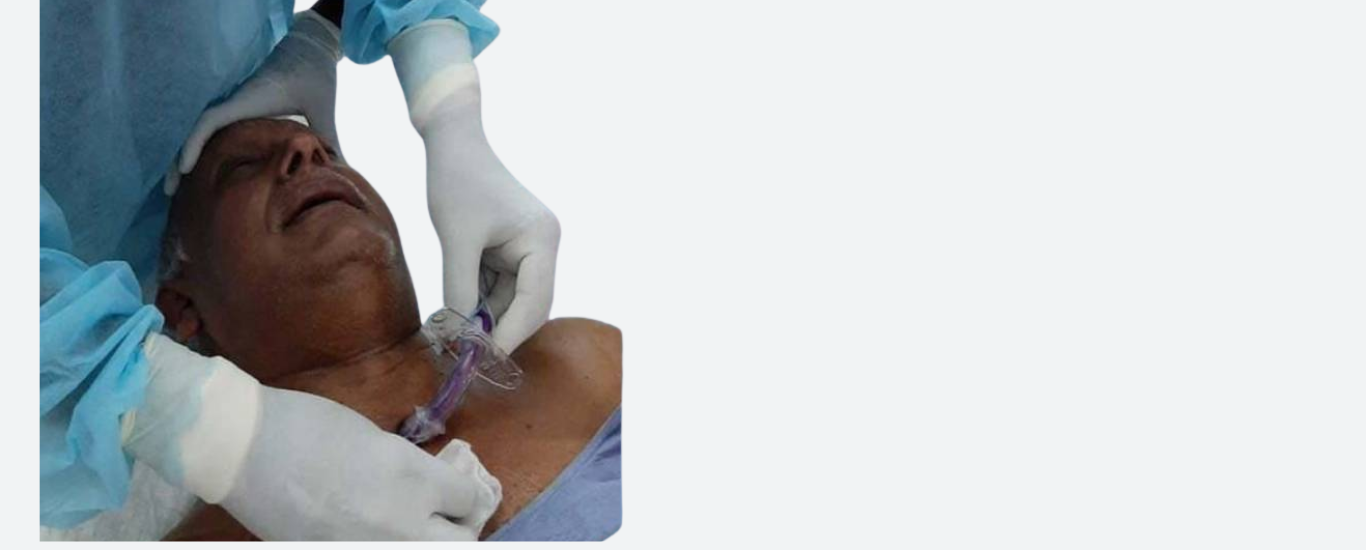 Tracheostomy Tube Change At Home