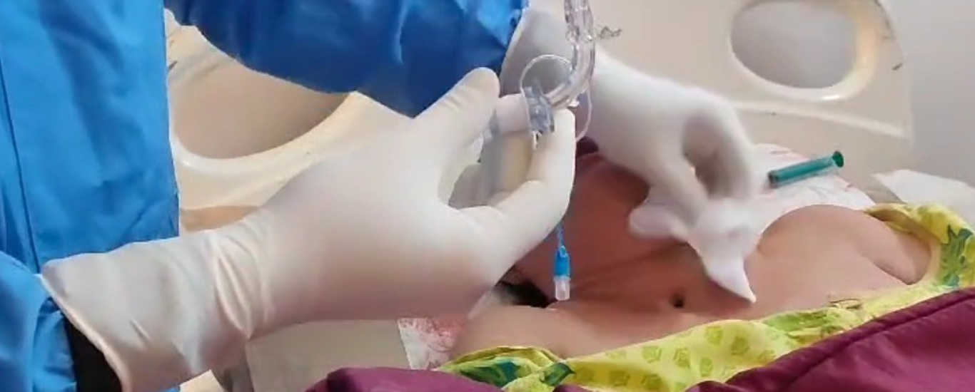 Tracheostomy Tube Change at Home | Expert Nursing Care – CareOxy