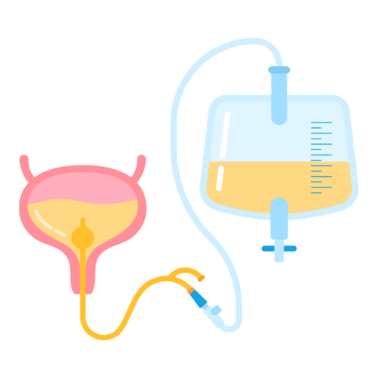 Urine Catheter Change At Home