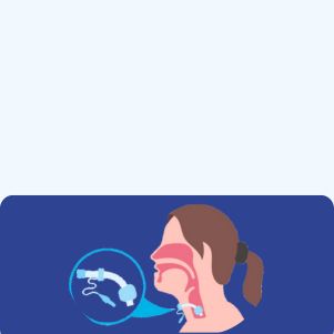 Tracheostomy Tube Change