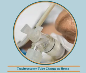 Best On-Call Home Short Visit Services – Tracheostomy Tube Change At Home