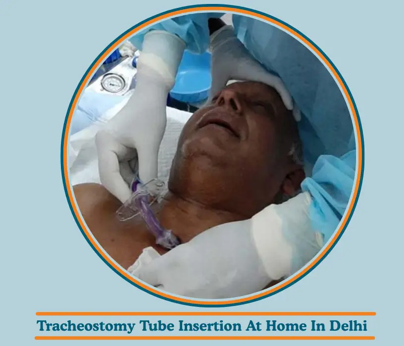 Tracheostomy Tube Insertion At Home In Delhi